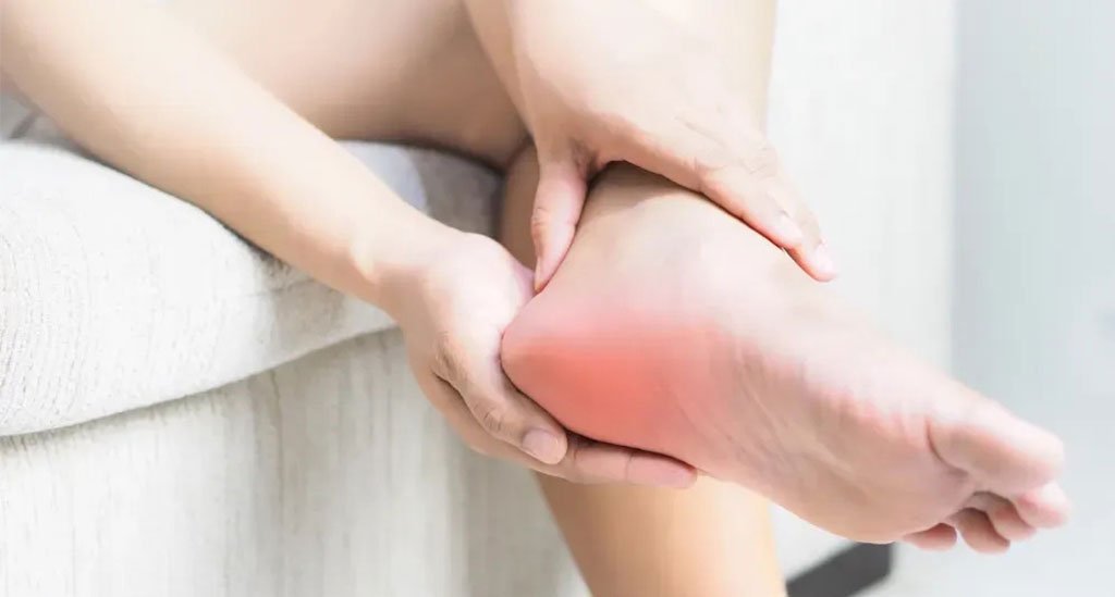 Plantar Fasciitis: A Comprehensive Guide to Understanding and Managing Heel Pain