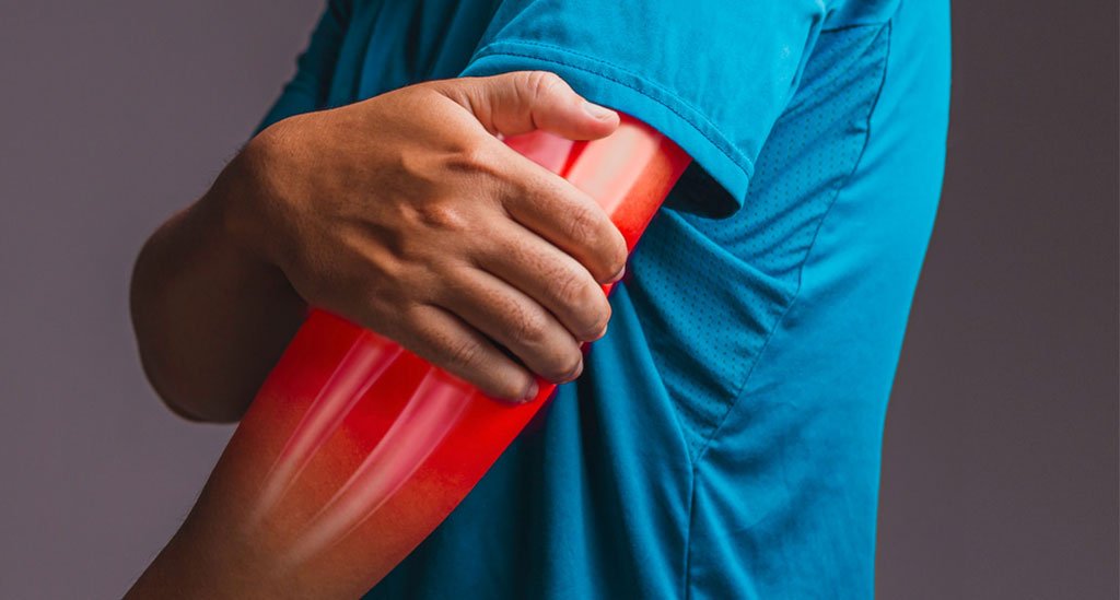 Understanding Tennis Elbow: Causes, Symptoms, and Treatment Strategies