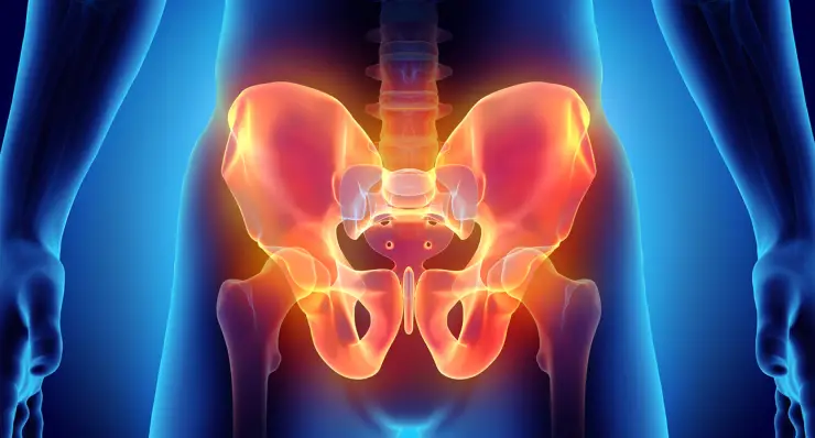 Pelvis Acetabular Trauma