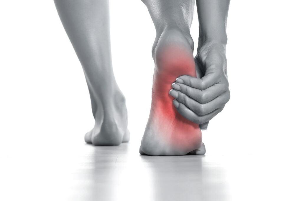 Plantar Fasciitis A Comprehensive Guide to Understanding and Managing Heel