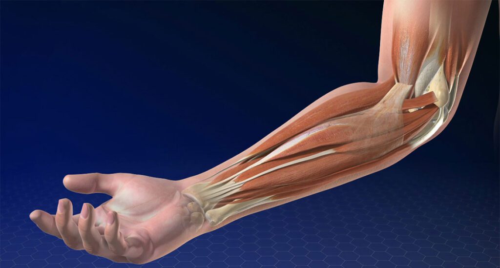 Elbow Renewed Navigating Recovery & Care After Replacement Surgery