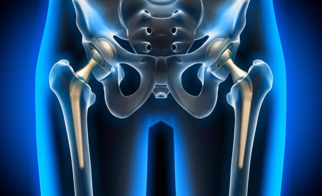 Hip Replacement Surgeon in Chandigarh Dr Ritesh Khokhar