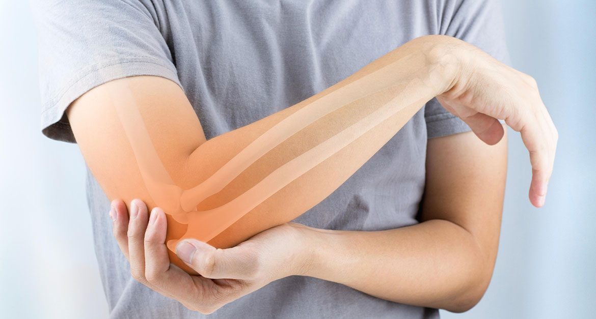 Mastering Mobility A Guide to Preparing for Elbow Replacement Surgery