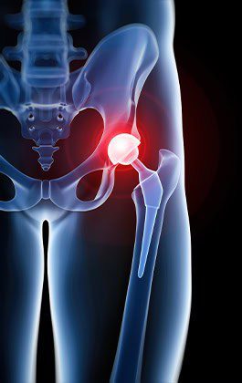 Hip Replacement Surgeon in Chandigarh Dr Ritesh Khokhar
